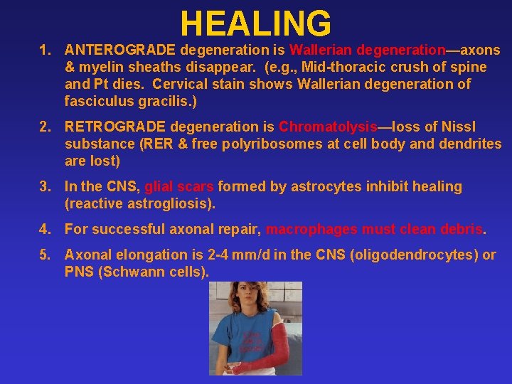 HEALING 1. ANTEROGRADE degeneration is Wallerian degeneration—axons & myelin sheaths disappear. (e. g. ,