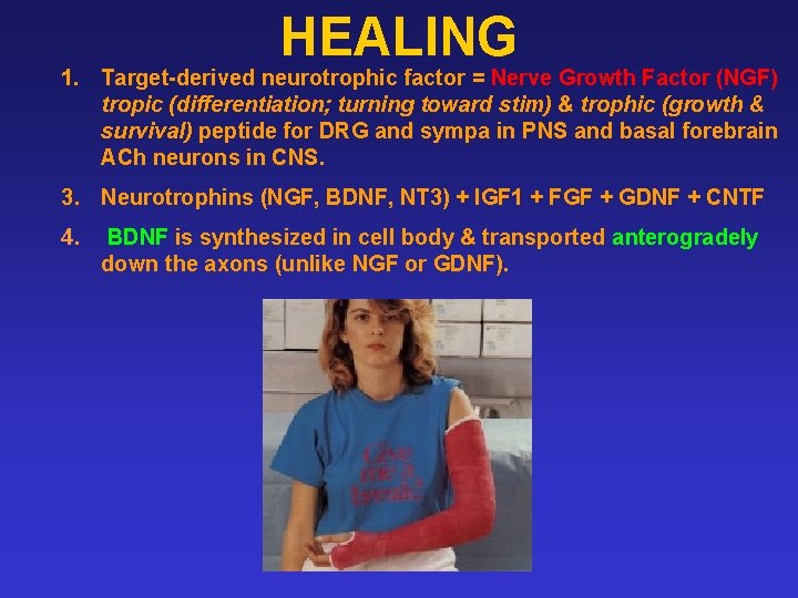 HEALING 1. Target-derived neurotrophic factor = Nerve Growth Factor (NGF) tropic (differentiation; turning toward