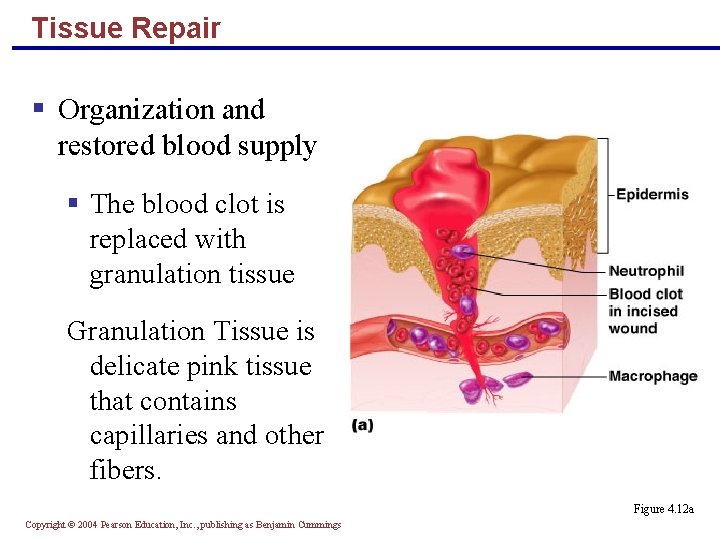 Tissue Repair § Organization and restored blood supply § The blood clot is replaced