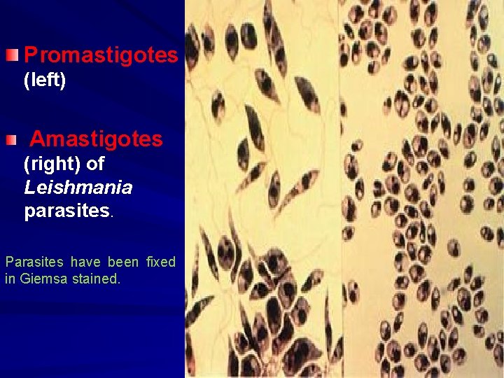 Promastigotes (left) Amastigotes (right) of Leishmania parasites. Parasites have been fixed in Giemsa stained.