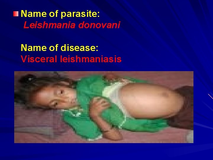 Name of parasite: Leishmania donovani Name of disease: Visceral leishmaniasis 
