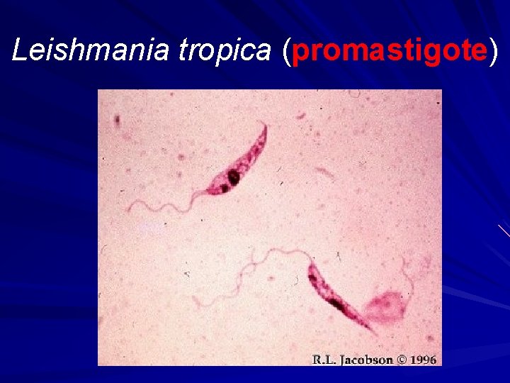 Leishmania tropica (promastigote) 