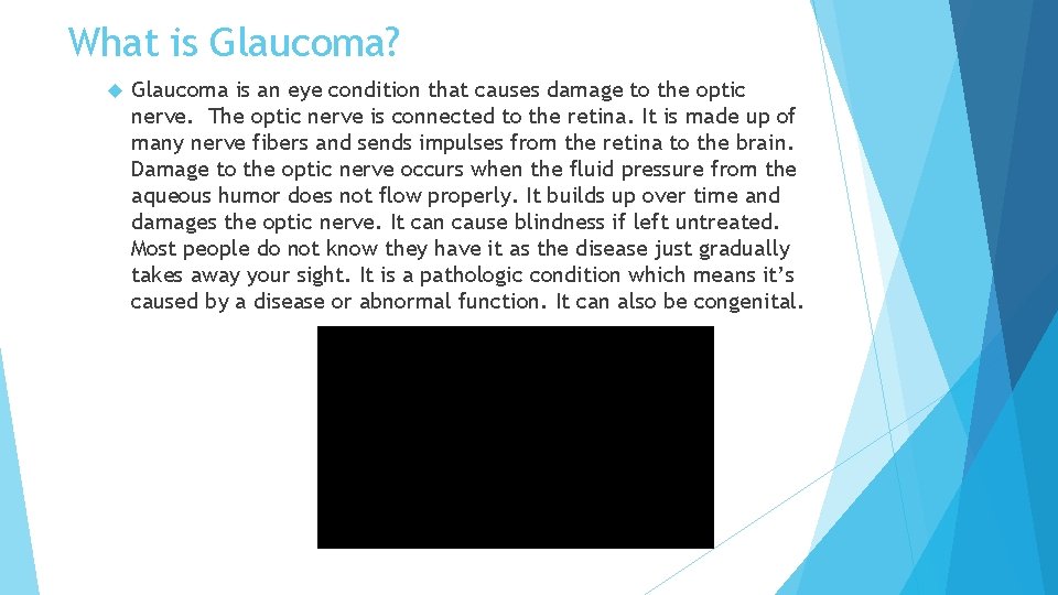 What is Glaucoma? Glaucoma is an eye condition that causes damage to the optic