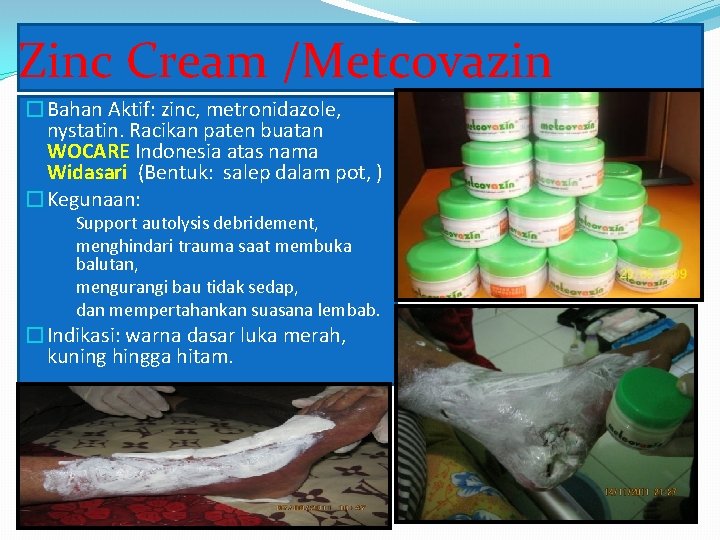 Zinc Cream /Metcovazin �Bahan Aktif: zinc, metronidazole, nystatin. Racikan paten buatan WOCARE Indonesia atas