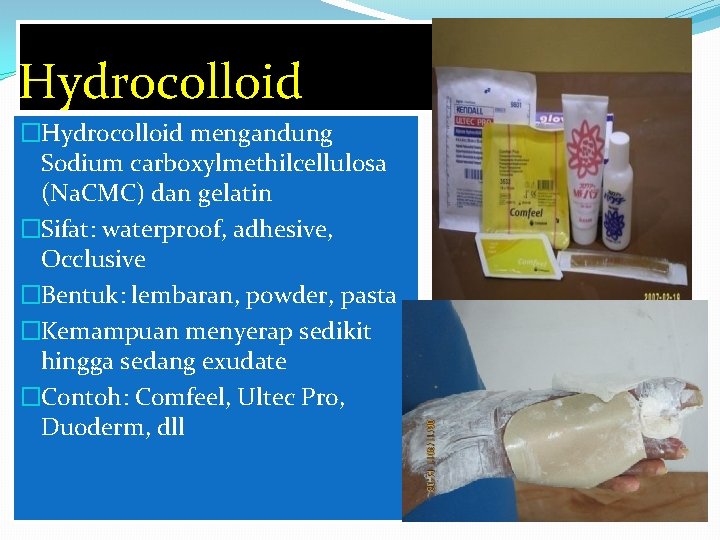 Hydrocolloid �Hydrocolloid mengandung Sodium carboxylmethilcellulosa (Na. CMC) dan gelatin �Sifat: waterproof, adhesive, Occlusive �Bentuk: