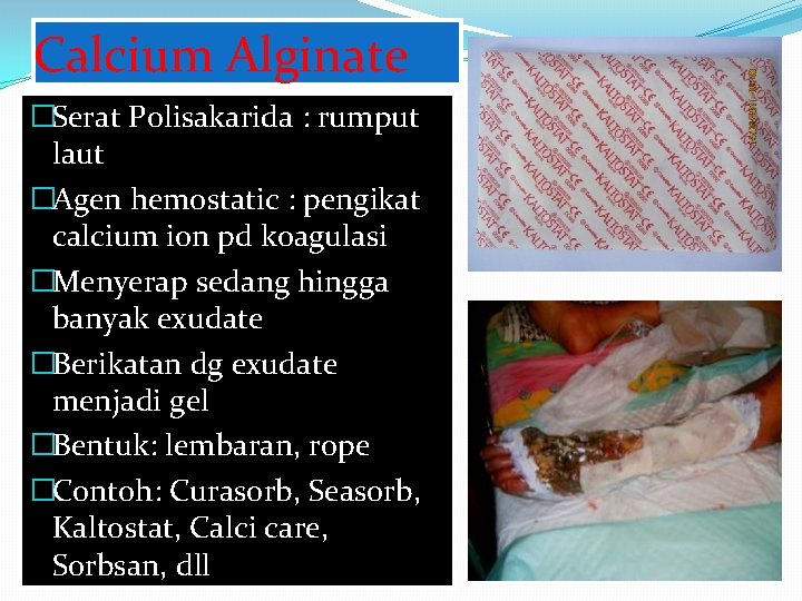 Calcium Alginate �Serat Polisakarida : rumput laut �Agen hemostatic : pengikat calcium ion pd