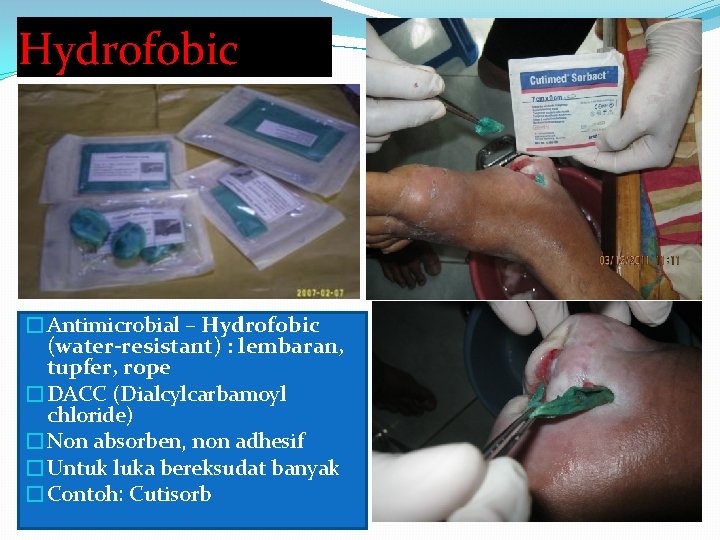 Hydrofobic �Antimicrobial – Hydrofobic (water-resistant) : lembaran, tupfer, rope �DACC (Dialcylcarbamoyl chloride) �Non absorben,