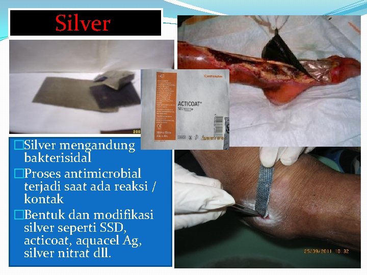 Silver �Silver mengandung bakterisidal �Proses antimicrobial terjadi saat ada reaksi / kontak �Bentuk dan