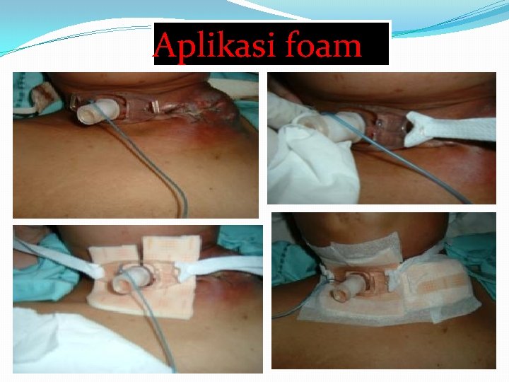 Aplikasi foam 