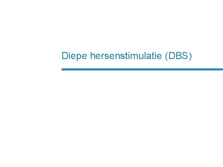 Diepe hersenstimulatie (DBS) 