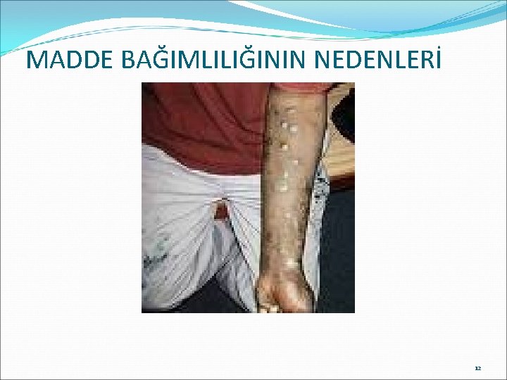 MADDE BAĞIMLILIĞININ NEDENLERİ 12 