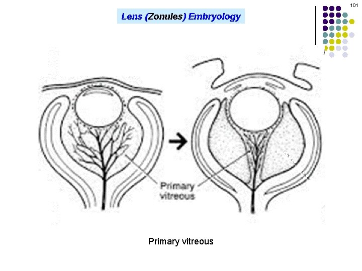 101 Lens (Zonules) Embryology Primary vitreous 