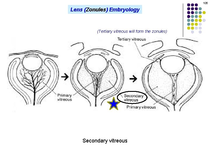 105 Lens (Zonules) Embryology (Tertiary vitreous will form the zonules) Secondary vitreous 