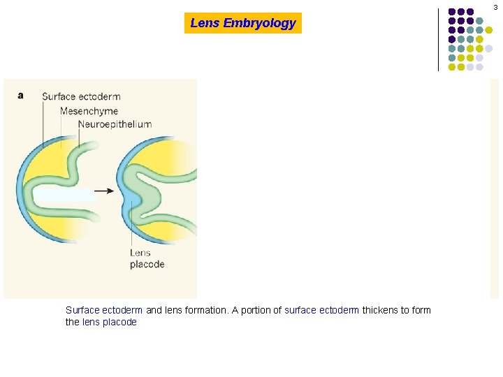 3 Lens Embryology Surface ectoderm and lens formation. A portion of surface ectoderm thickens