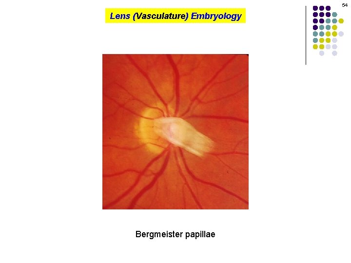 54 Lens (Vasculature) Embryology Bergmeister papillae 