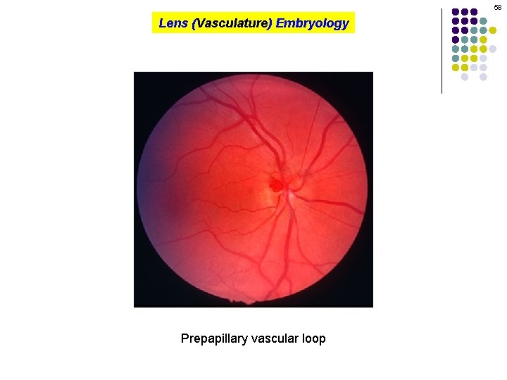 58 Lens (Vasculature) Embryology Prepapillary vascular loop 