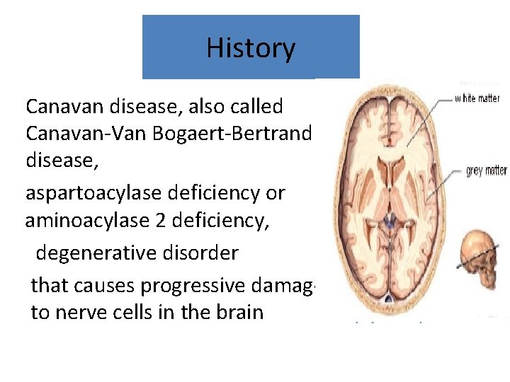 History Canavan disease, also called Canavan-Van Bogaert-Bertrand disease, aspartoacylase deficiency or aminoacylase 2 deficiency,