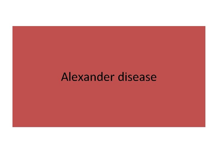 Alexander disease 