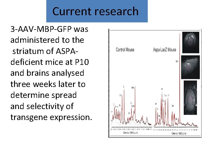 Current research 3 -AAV-MBP-GFP was administered to the striatum of ASPAdeficient mice at P