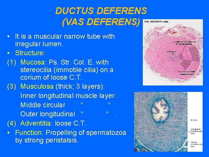 DUCTUS DEFERENS (VAS DEFERENS) • It is a muscular narrow tube with irregular lumen.