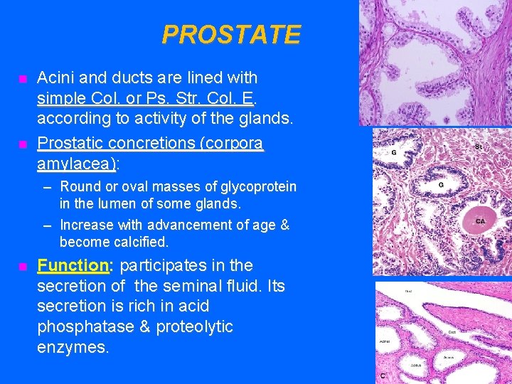 PROSTATE n n Acini and ducts are lined with simple Col. or Ps. Str.