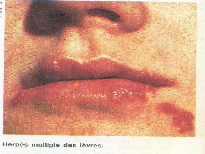 et n. ts i p s. i w w w 31 