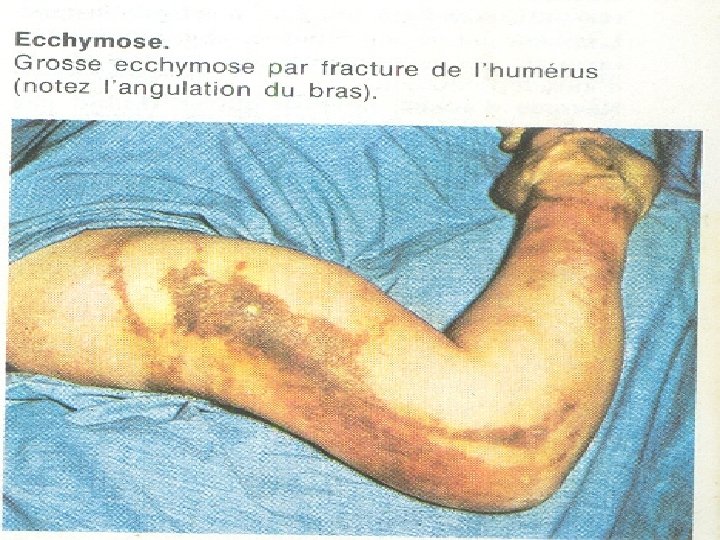 et n. ts i p s. i w w w 44 