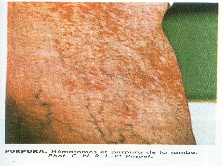 et n. ts i p s. i w w w 46 