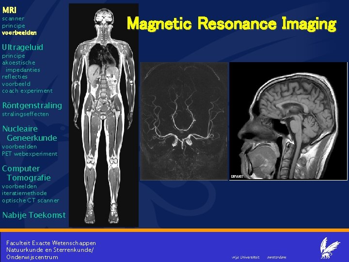 MRI scanner principe voorbeelden Ultrageluid principe akoestische impedanties reflecties voorbeeld coach experiment Röntgenstralingseffecten Nucleaire