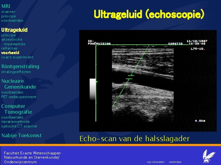 MRI scanner principe voorbeelden Ultrageluid (echoscopie) Ultrageluid principe akoestische impedanties reflecties voorbeeld coach experiment