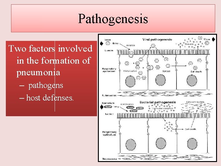 Pathogenesis Two factors involved in the formation of pneumonia – pathogens – host defenses.