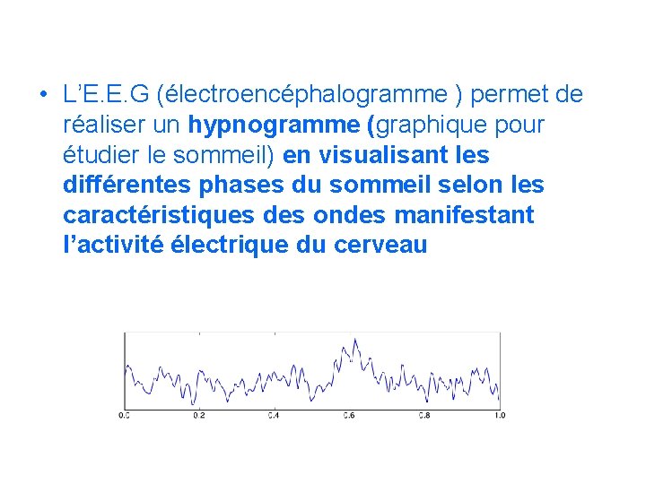 • L’E. E. G (électroencéphalogramme ) permet de réaliser un hypnogramme (graphique pour