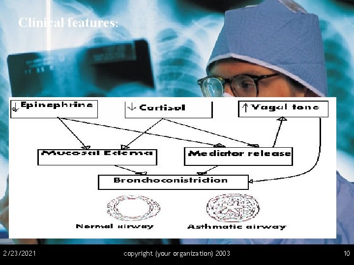 Clinical features: 2/23/2021 copyright (your organization) 2003 10 