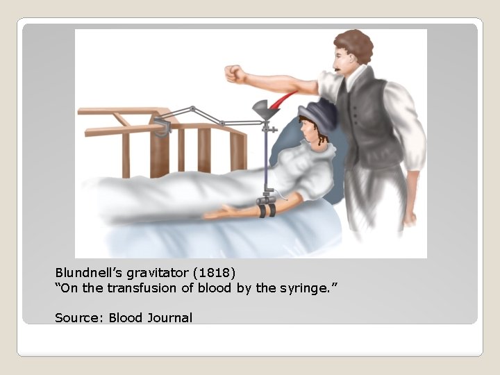 Blundnell’s gravitator (1818) “On the transfusion of blood by the syringe. ” Source: Blood