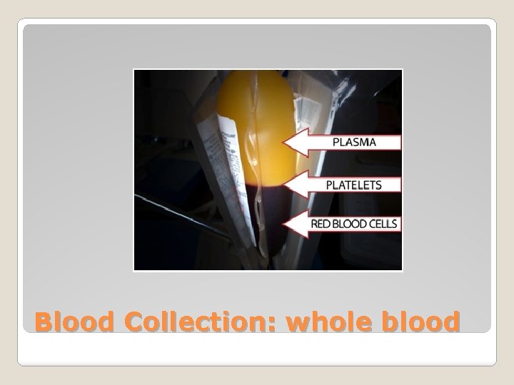 Blood Collection: whole blood 