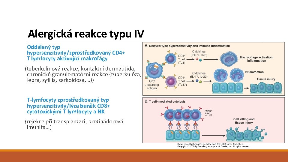 Alergická reakce typu IV Oddálený typ hypersenzitivity/zprostředkovaný CD 4+ T lymfocyty aktivující makrofágy (tuberkulinová