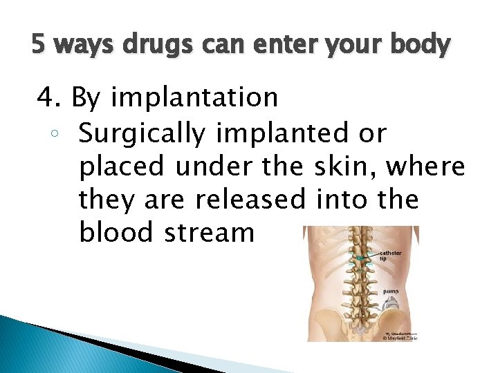 5 ways drugs can enter your body 4. By implantation ◦ Surgically implanted or