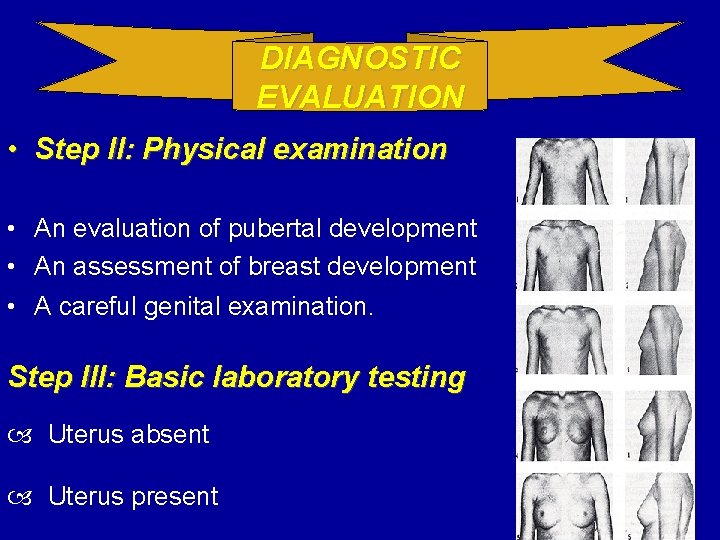 DIAGNOSTIC EVALUATION • Step II: Physical examination • An evaluation of pubertal development •