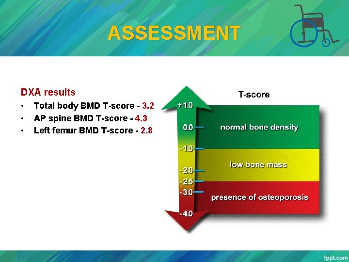 ASSESSMENT DXA results • • • Total body BMD T-score - 3. 2 AP