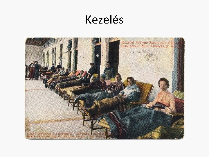 Kezelés 
