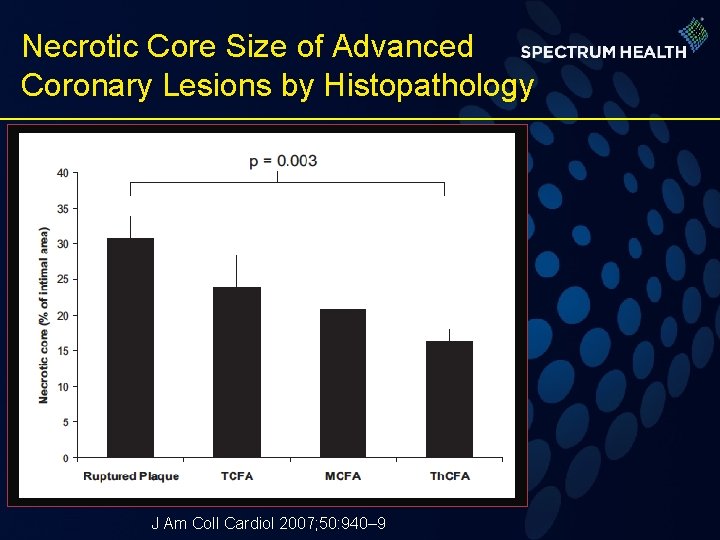 Necrotic Core Size of Advanced Coronary Lesions by Histopathology J Am Coll Cardiol 2007;