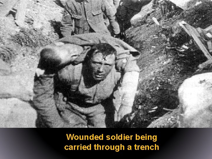 Wounded soldier being carried through a trench 