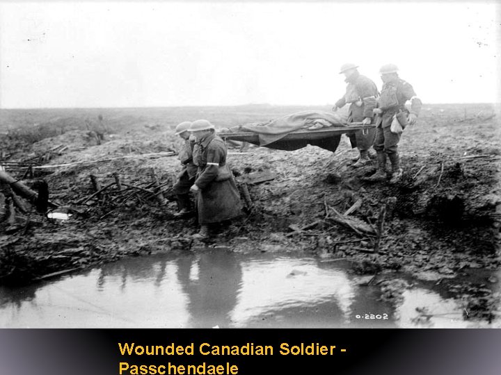 Wounded Canadian Soldier Passchendaele 