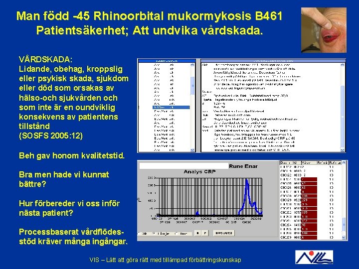 Man född -45 Rhinoorbital mukormykosis B 461 Patientsäkerhet; Att undvika vårdskada. VÅRDSKADA: Lidande, obehag,