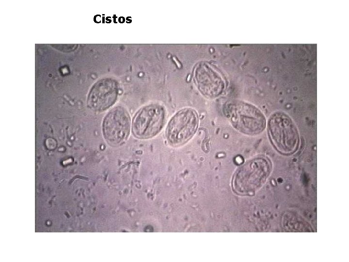 Cistos 