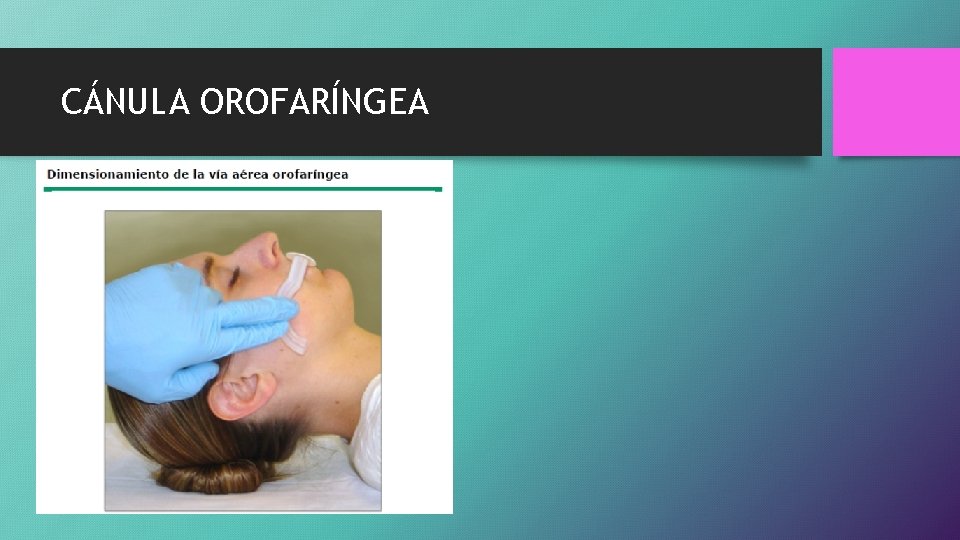 CÁNULA OROFARÍNGEA 