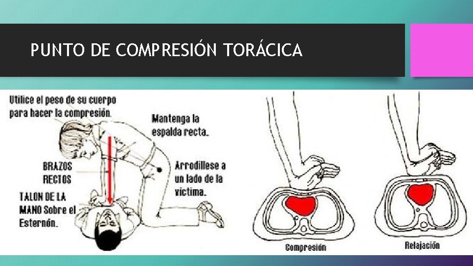 PUNTO DE COMPRESIÓN TORÁCICA 