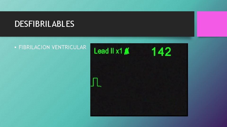 DESFIBRILABLES • FIBRILACION VENTRICULAR 
