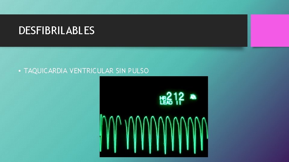 DESFIBRILABLES • TAQUICARDIA VENTRICULAR SIN PULSO 