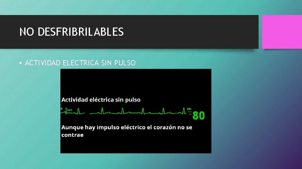 NO DESFRIBRILABLES • ACTIVIDAD ELECTRICA SIN PULSO 